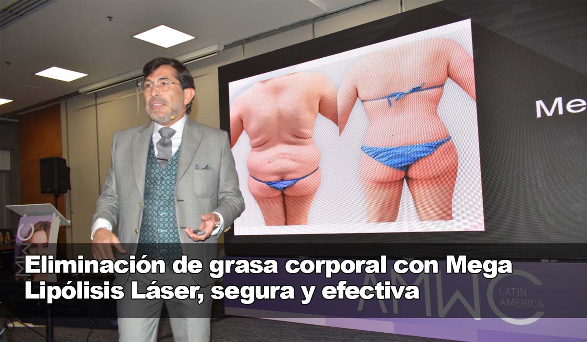 Deshacerse de grasa corporal con eliminación segura y efectiva de Mega Lipólisis Láser